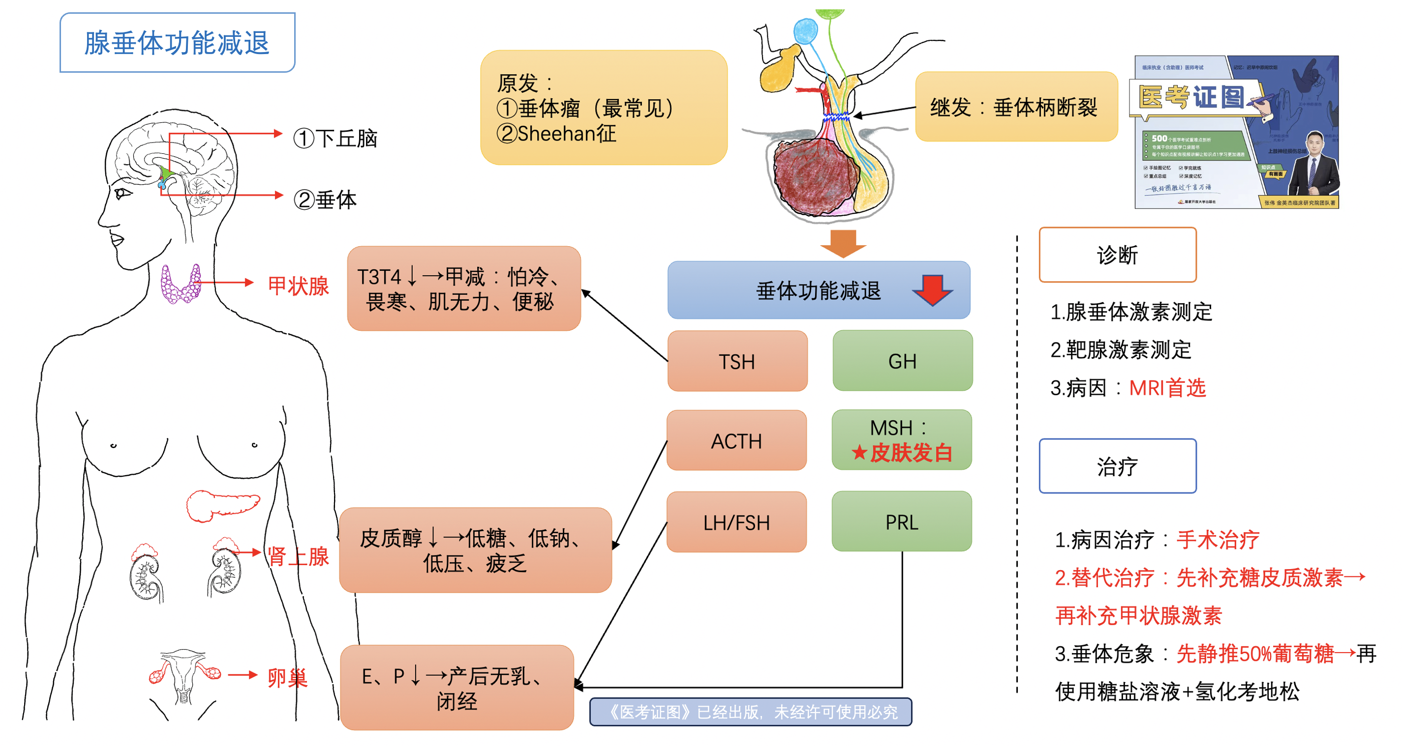 腺垂体功能减退症.png